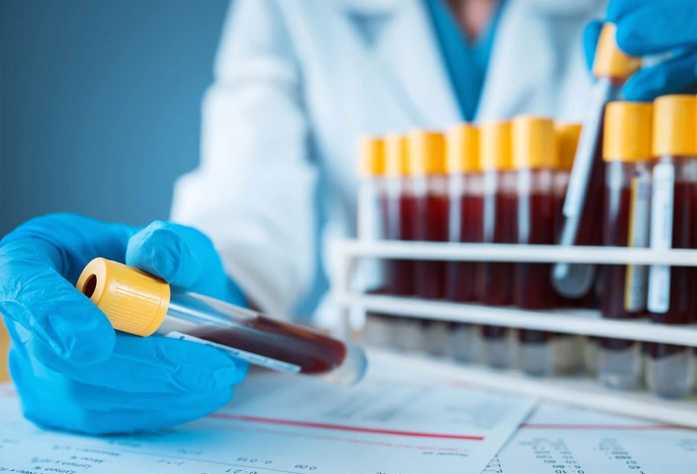 Raised Blood Prolactin Levels (Hyperprolactinemia) in Women Undergoing Infertility Treatment