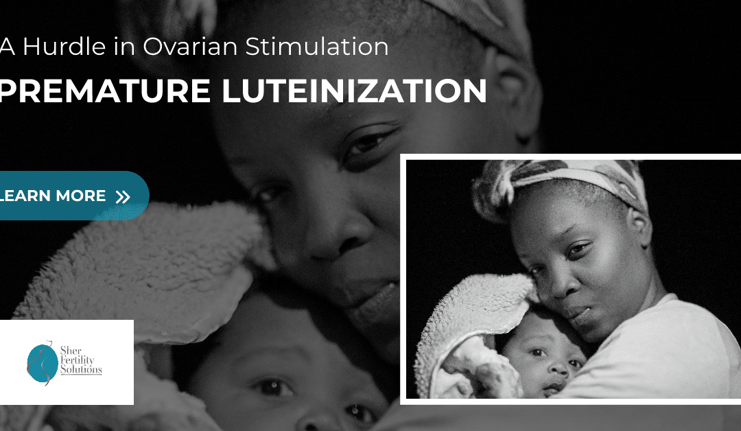 Premature Luteinization: A Hurdle in Ovarian Stimulation